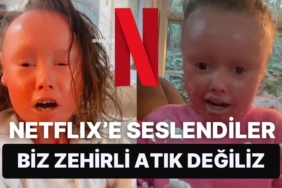 netflixteki-bir-filmde-olumcul-cilt-hastasi-olan-cocuklarin-goruntulerinin-kullanilmasi-tepki-cekti-rus7wQxu.jpg