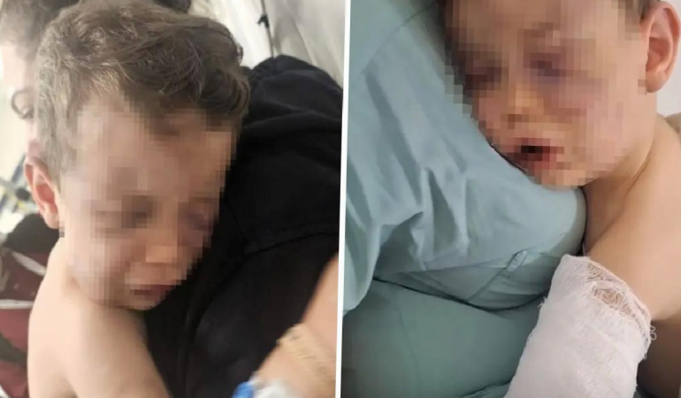 Annesinin sevgilisinin öldüresiye darbettiği Aren bebeği yakmaya çalışmışlar